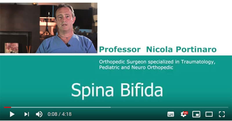 Spina Bifida Video Nicola Portinaro Chirurgo Ortopedico Pediatrico