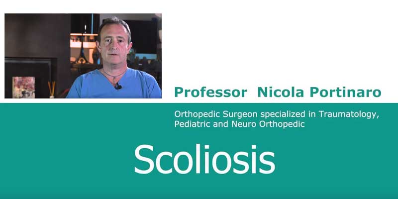video scoliosis nicola portinaro
