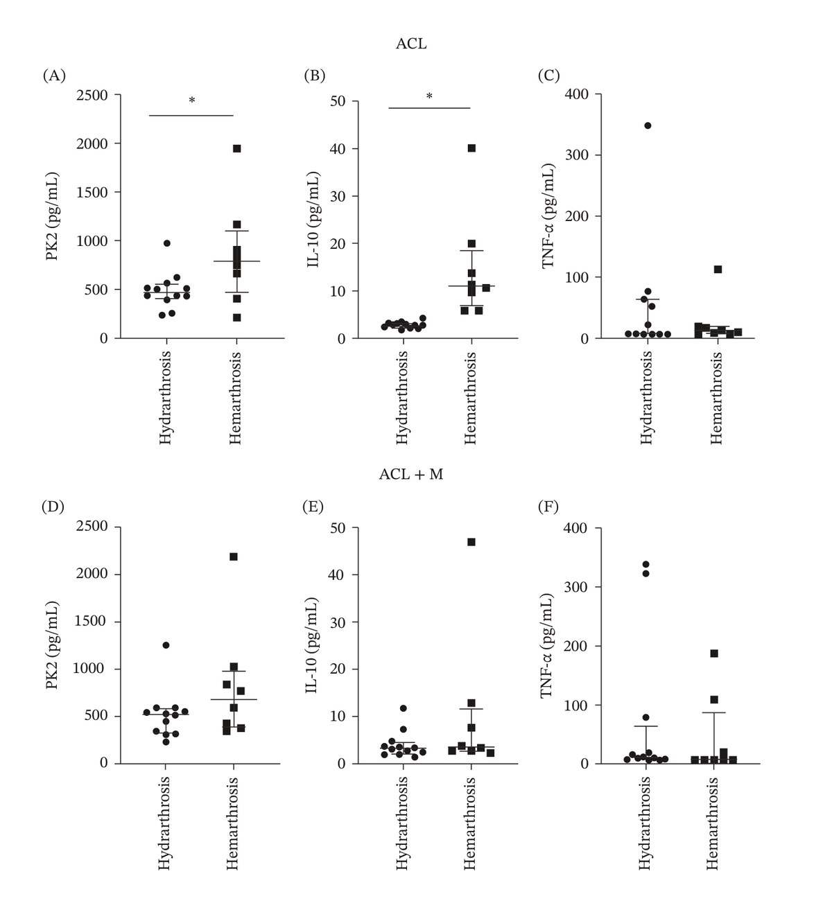 Grafici dei livelli di procineticina-2, IL-10 e TNF-α con emartro e con idrarto, in pazienti con lesione del crociato anteriore isolata o associata a lesione del menisco